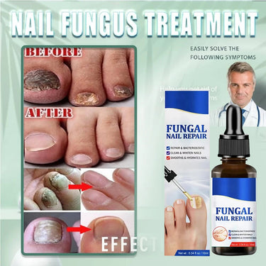 Fungal Nail Treatment Essence Oil